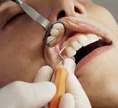 OPEN MOUTH WITH MIRROR DENTAL