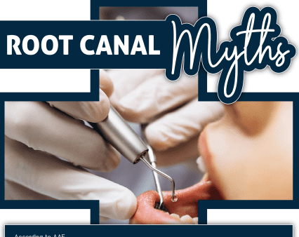 root canal