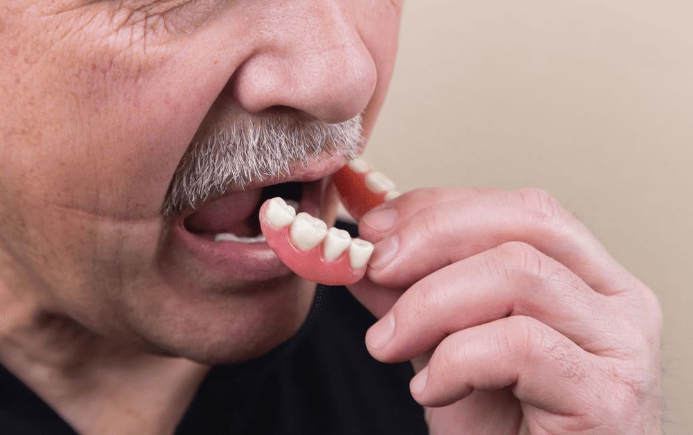 A man inserting dentures